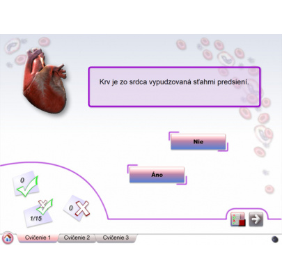 Cievna sústava (DL)