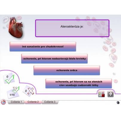 Cievna sústava (DL)