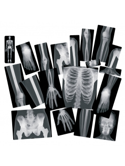 Röntgeny ľudského tela