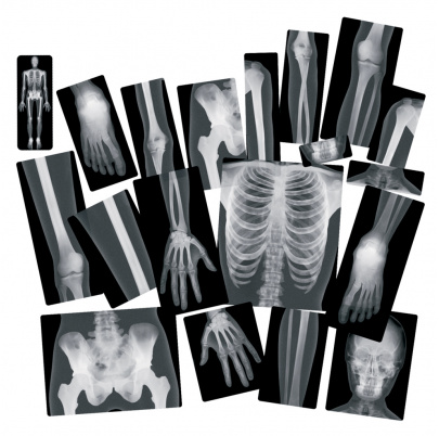 Röntgeny ľudského tela