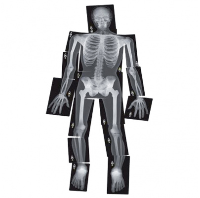 Röntgeny ľudského tela