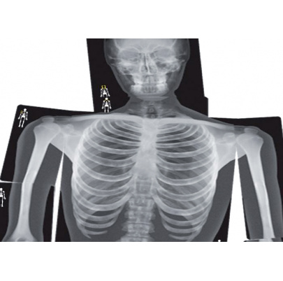 Röntgeny ľudského tela