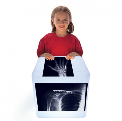 RTG snímky napravených zlomenín kostí