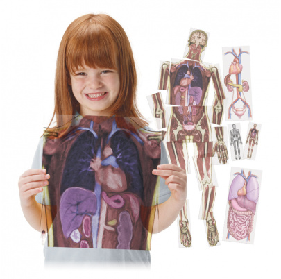 Pozri sa do mňa, celotelový MR sken